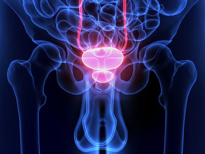 “Novembro Azul”: campanha ressalta a prevenção do câncer de próstata, principal causa de mortes por tumor entre os homens gaúchos