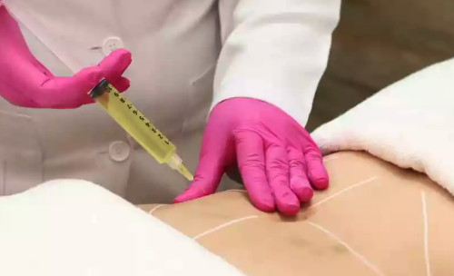A Recuperação Após a Cirurgia de Lipoaspiração: Dicas Importantes